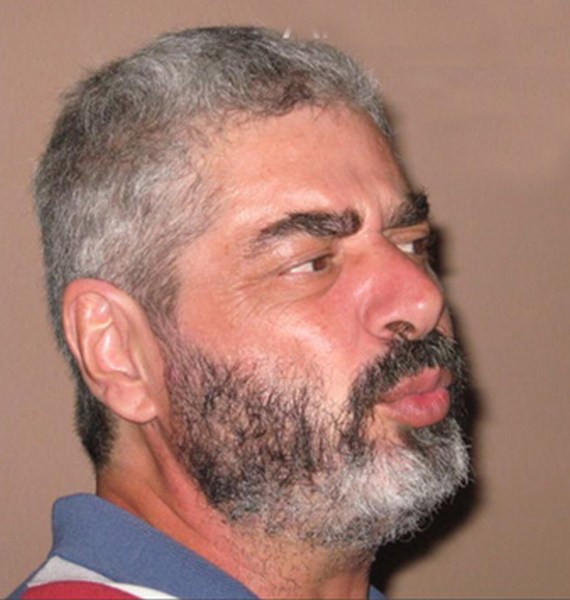 Antonio Bandrés Oscoz